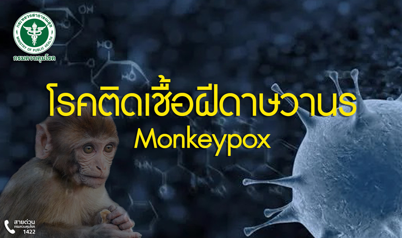 โรคติดเชื้อฝีดาษวานร (Monkeypox)
